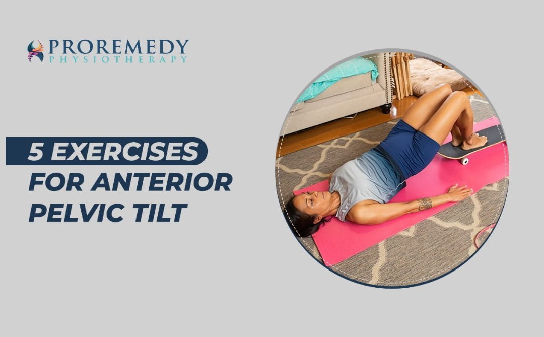 5 Exercises for Anterior Pelvic Tilt to reduce pain