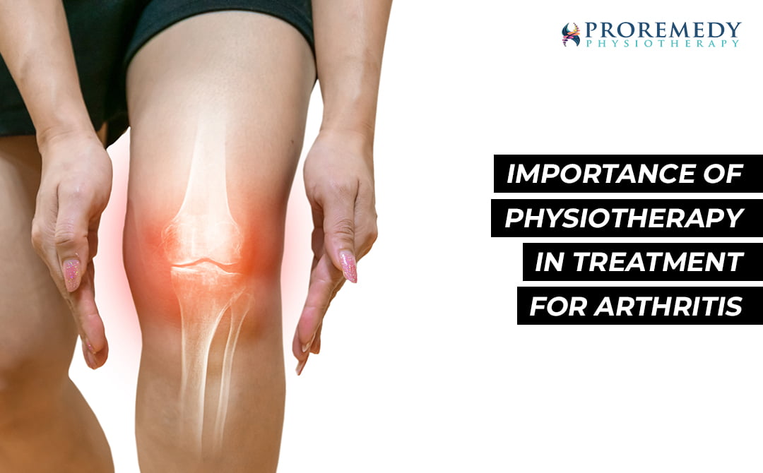 Physiotherapy Treatment for Arthritis