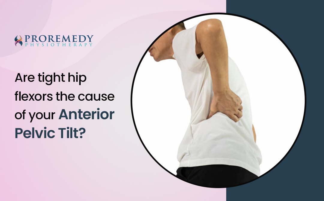 tight hip flexors is the main cause for anterior pelvic tilt